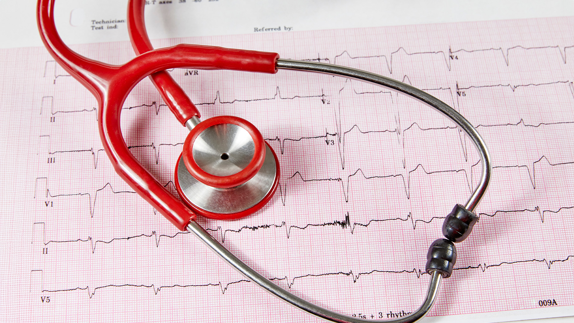 A red stethoscope with a black earpiece resting on an ECG graph with pink grid lines, suggesting medical equipment used for monitoring heart function.